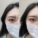 대구속눈썹펌 잘하는 곳 리안뷰티
