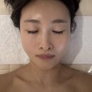 리본스킨케어 | [의정부 피부관리] 리본뷰티스튜디오 소프트 플라즈마 스킨케어 솔직 후기! 효과&amp;후 관리까지