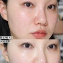 랩82 | 붉은피부 가라앉으려면? 피부진정 홈케어 추천 레이어랩 니오좀 판테놀 세럼 후기