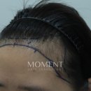 모먼트의원 이미지