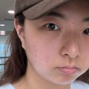 써니 - 화성시 역골로 9-13 | 부평피부과 써니리프팅 내돈내산 후기