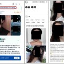 팍스메디컬 | 경제적 이해관계 누락한 후기 광고…공정위, 성형외과 3곳 시정명령