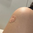 강동천호내과의원 | 강동구 천호역 백일해주사 가장 저렴한 곳 속든든내과의원(백일해 기본정보)