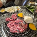 연세결성형외과의원 | 이직성공 후 서면성형외과에서 진행한 눈밑지방재배치(붓기와 멍 위주의 솔직 후기)