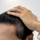 모디헤어플란트의원 이미지