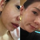 매력적인셀덤 - 동래구 | 한 번 쓰면 재구매하게 되는 인셀덤의 매력