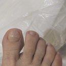 분당내곡로 | 판교내성발톱 판교발관리 레푸스 분당판교점 홍윤주 부원장님 후기