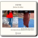 원주다이어트한의원 탕약, 환, 시럽 다양한 제형으로