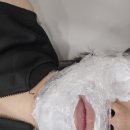 아름다움의원 | 아름다움을 만나게 해준 의원 레제+레이저 토닝 후기(with 젠틀맥스 프로 플러스)