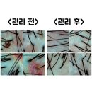 쑴숨쉬듯휴식하다&숲칼프 | 아산 배방 두피관리 '쑴숨쉬듯휴식하다&숲칼프' 후기