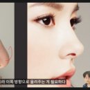 마침표성형외과의원 네이버블로그
