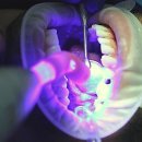 대전센텀병원 | 제 고민 해결! 속 시원했던 사랑니 발치 후기 feat. 대전 치과