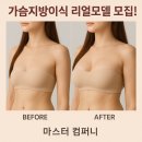 가슴지방이식 성형리얼모델모집 마스터컴퍼니에서!