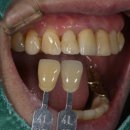 어울림치과기공소 이미지