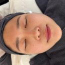 원주피부관리 제이앤스킨케어에서 수분 요철 비립종 관리 받고 온 후기