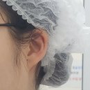 장미꽃과 나이팅게일 피부과의원 | 피지 낭종 핀홀법 제거 후기 및 관리법