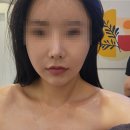 피부, 빛나리 에스테틱 | 서산피부관리 후기💆‍♀️ 예천동 ‘빛나리움 에스테틱’에서 예천피부관리 & 웨딩관리 받았어요!”