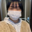 대구 시내 쌍꺼풀수술 후기 (절개 + 앞트임 + 눈매교정) / 수술당일 주의사항, 붓기빼는약, 경과 변화...