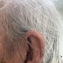 목동독일보청기 이미지