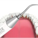 단단플란트치과의원 이미지