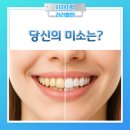 스페셜치과의원 | 강남 신논현역 치과 전문가 치아미백 종류 총정리!