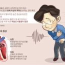 평균 심장박동수 정상 수치 심장박동 빠름 불규칙 놔두면 안 돼요 이미지