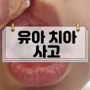동탄어린이치과의원 네이버블로그