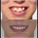 삐뚤한이바르게치과교정과치과의원 이미지