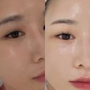 더베스트짐 | 역삼 에스테틱 미더베스트 셀럽시크릿케어 수분, 탄력 관리 후기