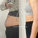 리핏 | 강남 복부지방분해주사 리핏주사 상세후기