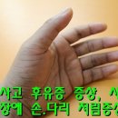 교통사고 후유증 증상, 교통사고후 후유장애 손.다리 저림증상 이미지