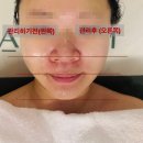 구리신부관리 하이퍼소닉관리 아트강뷰티 웨딩관리 추천 후기