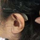 세종대평시장(고객지원센터) | 오송보청기 세종까지, 소문 듣고 찾아오신 어머님의 포낙 인피니오 착용 후기