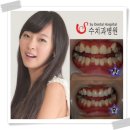 서울수치과 이미지