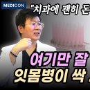 잇몸에서 피날 때 치과에서 하지말고 집에서 하세요. 돈 한푼 안들이는 잇몸병 해결방법. 치은염. 치주염 이겨내는 방법. 양치질 습관. 이미지