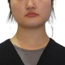 신데렐라성형외과의원 | 안면비대칭 교정기, 교정 비용10군데 비교 후 내린 결론