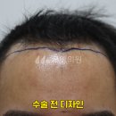 모엠