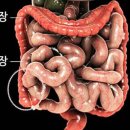 명인약손 이미지