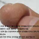 3쾌4무 藥 비누 사용 2년...몸의 변화 이미지