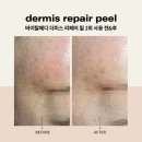 메디리버