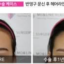 모앤라인성형외과의원 네이버블로그