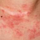 미클린의원 이미지