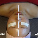 피부맑음 에스테틱 이미지