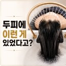 브로우제이 - 시흥시 서울대학로278번길 26 | 포항헤드스파 | 내 두피에 이런 묵은 때가? 브로우제이 관리 후기