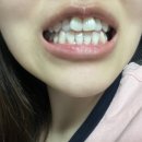 더하얀의원 | 웨딩 예신관리 추천, 강남 치아미백 후기