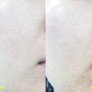 주식회사 메디안스 | 피부에 비타민C공급 히스토메르씨 퓨어 비타민앰플으로 해요 [대표카페지후맘/주식회사메디안스]