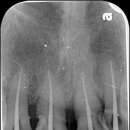 엔도코어 이미지