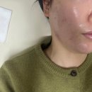 롯데캐슬프리미어아파트경로당 | 마산피부관리 잘하는 곳 수앤유뷰티에서 페이스 리프팅 받고 온 후기