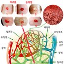 만병을 만드는 체내 염증, 림프액 다스리는 방법 이미지