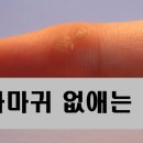 http://www.tistory.com/m/search/%ED%8E%B8%ED%8F%89%EC%82%AC%EB%A7%88%EA%B7%80%20%EC%97%86%EC%95%A0%EB%8A%94%20%EB%B0%A9%EB%B2%95 티스토리
